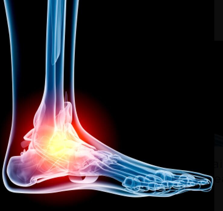 Images Rite Step Orthotics