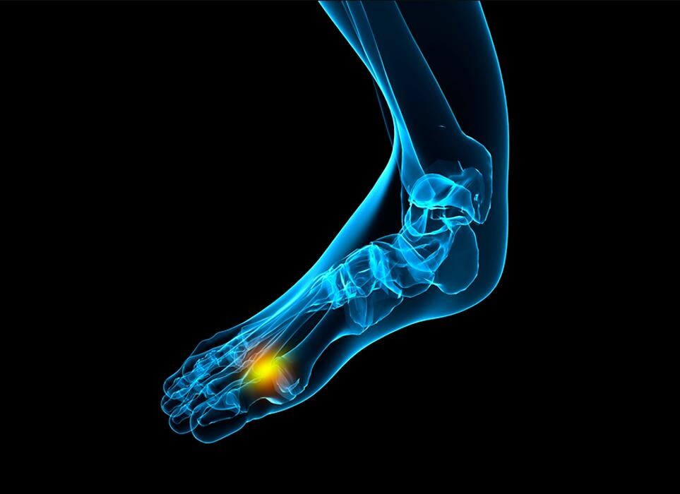 Images Rite Step Orthotics