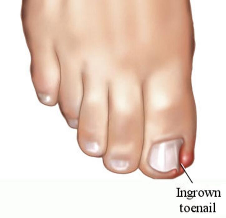 Images Rite Step Orthotics