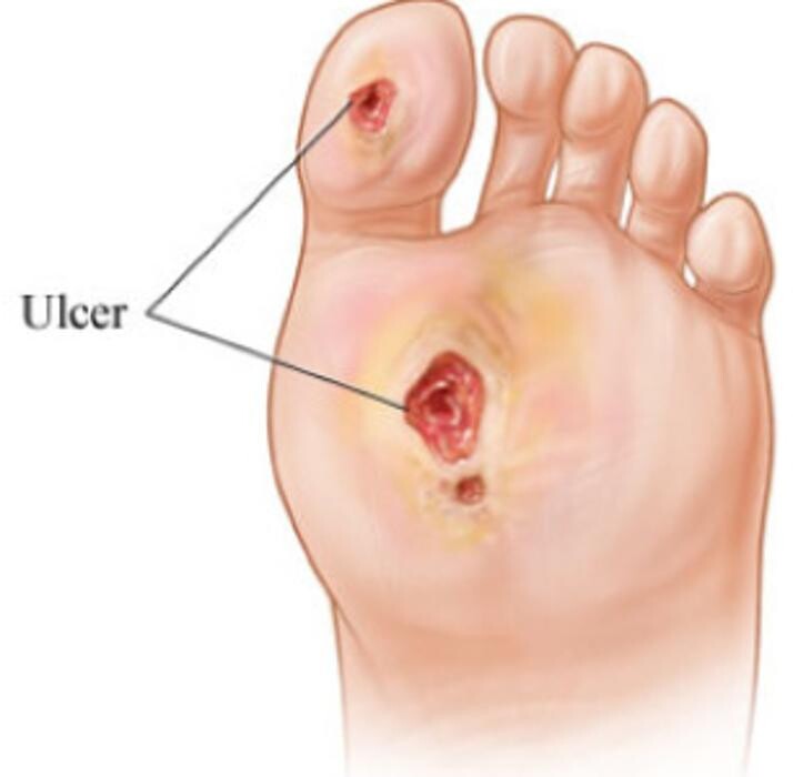 Images Rite Step Orthotics