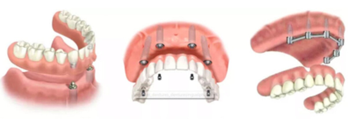 Images Record Ridge Denture Clinic Inc