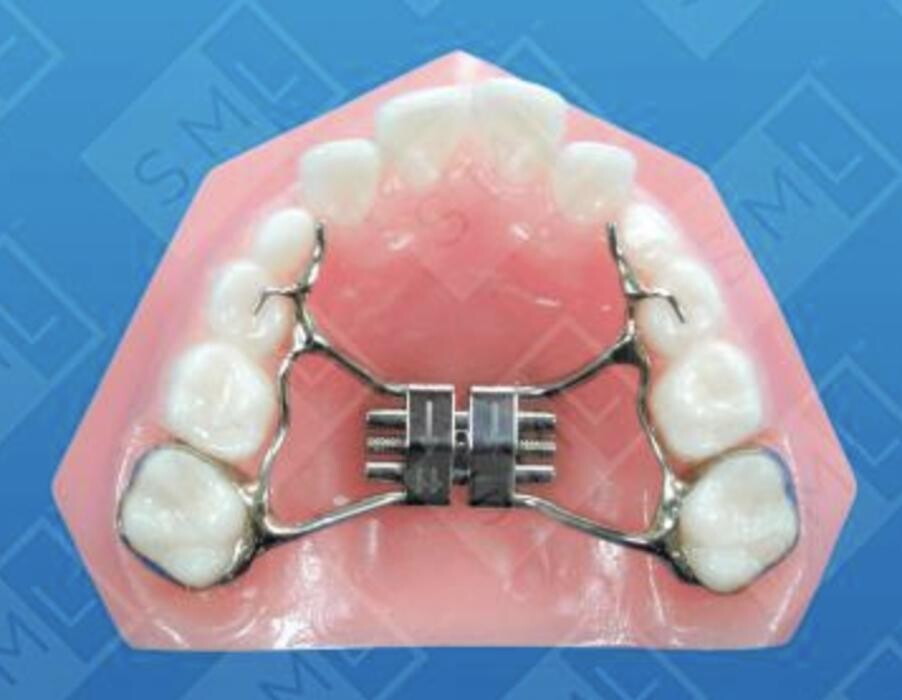 Images Impact Orthodontics SE