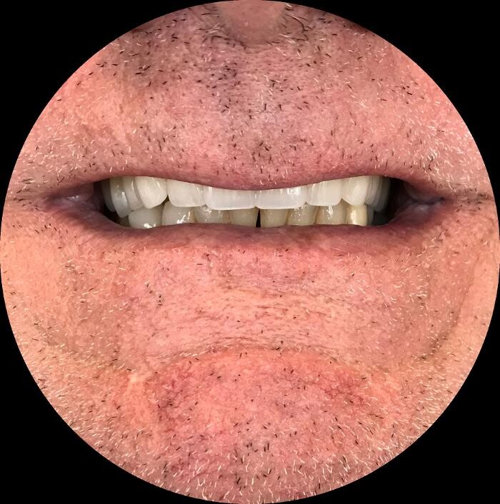 Images Winnipeg Denture & Implant Centre