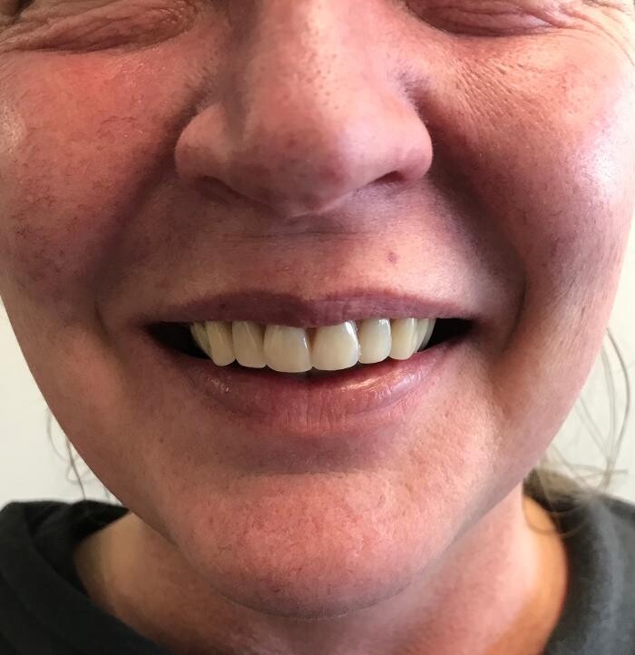 Images Winnipeg Denture & Implant Centre