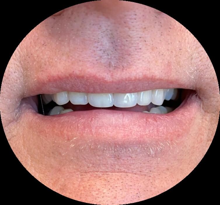 Images Winnipeg Denture & Implant Centre
