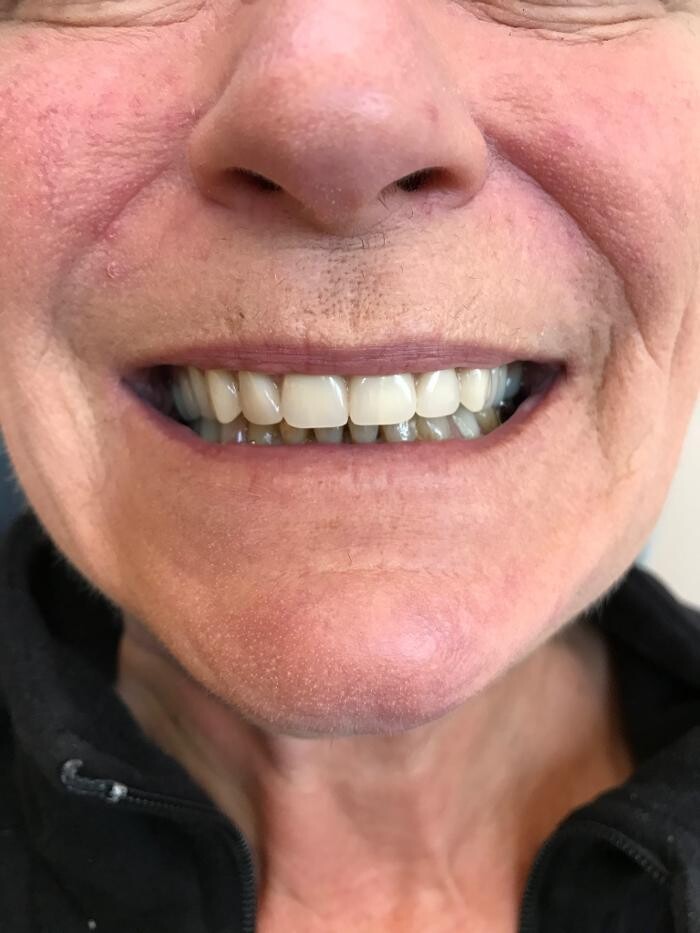 Images Winnipeg Denture & Implant Centre