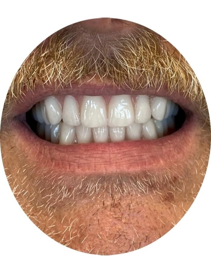 Images Winnipeg Denture & Implant Centre
