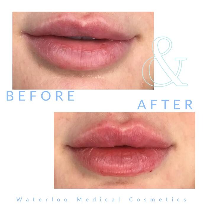 Images Waterloo Medical Cosmetics