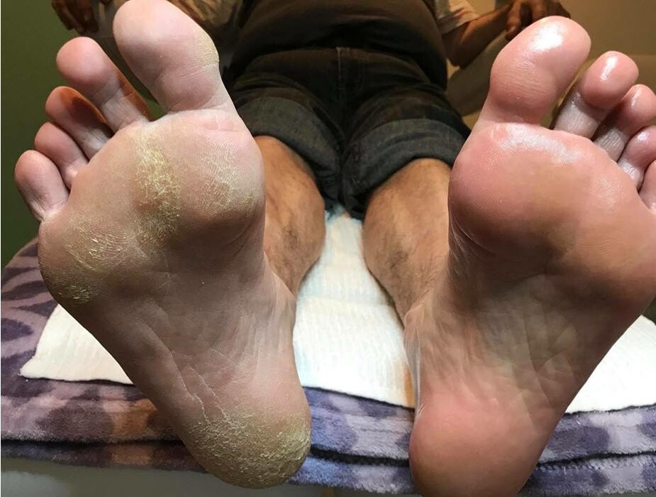 Images À la Pointe des Pieds