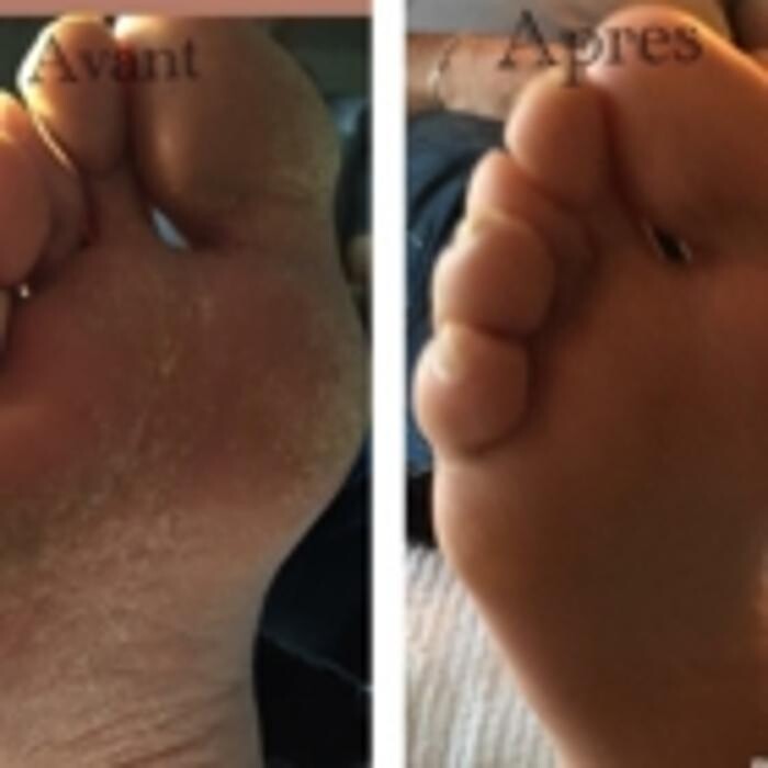 Images À la Pointe des Pieds