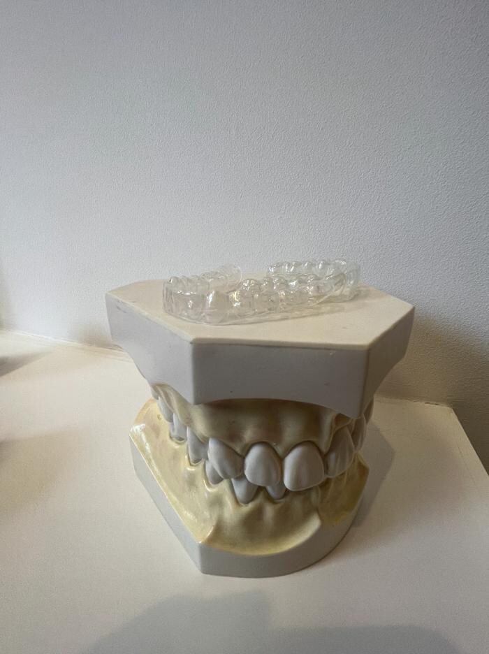 Bilder L'Orthodontiste numérique - Dr Tobler et Dr Le Carboulec