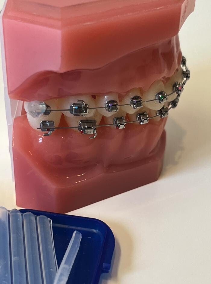 Bilder L'Orthodontiste numérique - Dr Tobler et Dr Le Carboulec