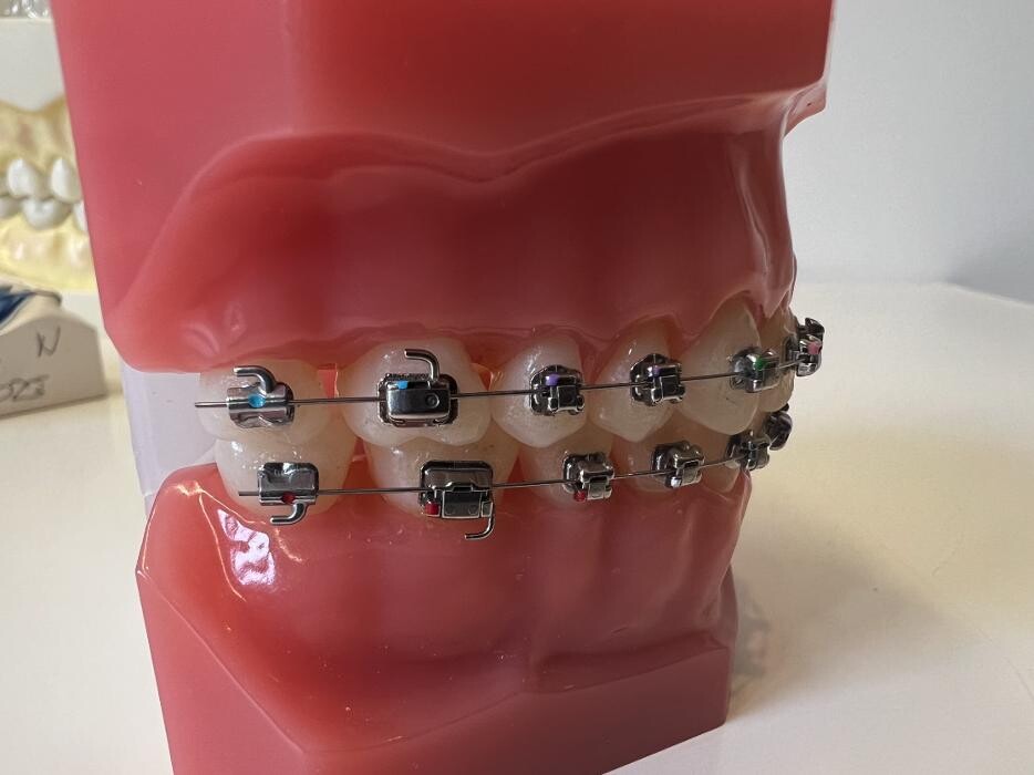 Bilder L'Orthodontiste numérique - Dr Tobler et Dr Le Carboulec