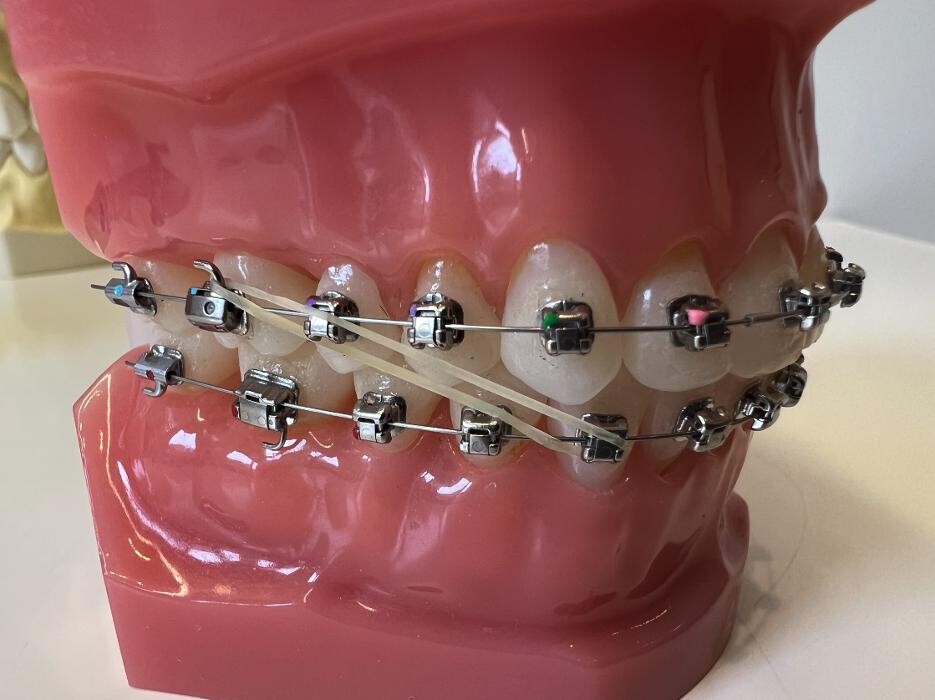 Bilder L'Orthodontiste numérique - Dr Tobler et Dr Le Carboulec