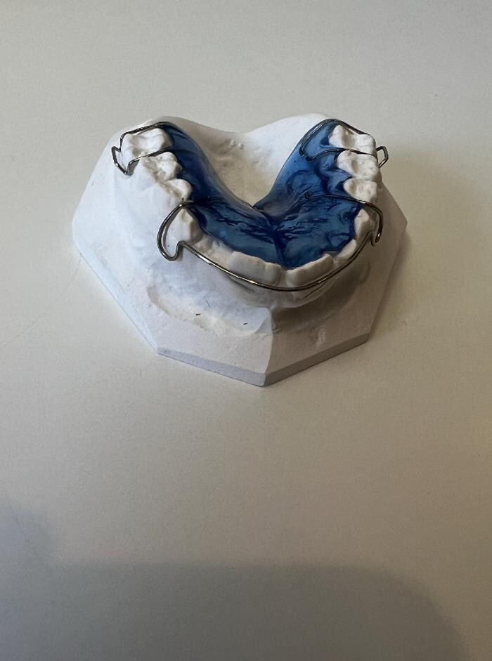 Bilder L'Orthodontiste numérique - Dr Tobler et Dr Le Carboulec