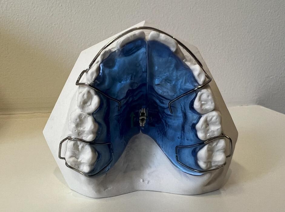 Bilder L'Orthodontiste numérique - Dr Tobler et Dr Le Carboulec