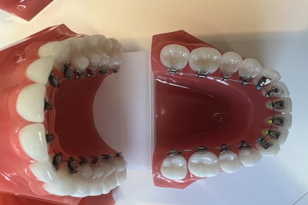 Bilder L'Orthodontiste numérique - Dr Tobler et Dr Le Carboulec