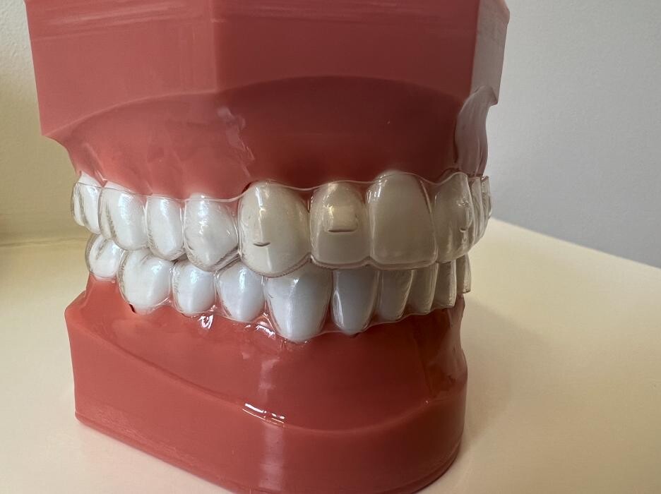 Bilder L'Orthodontiste numérique - Dr Tobler et Dr Le Carboulec