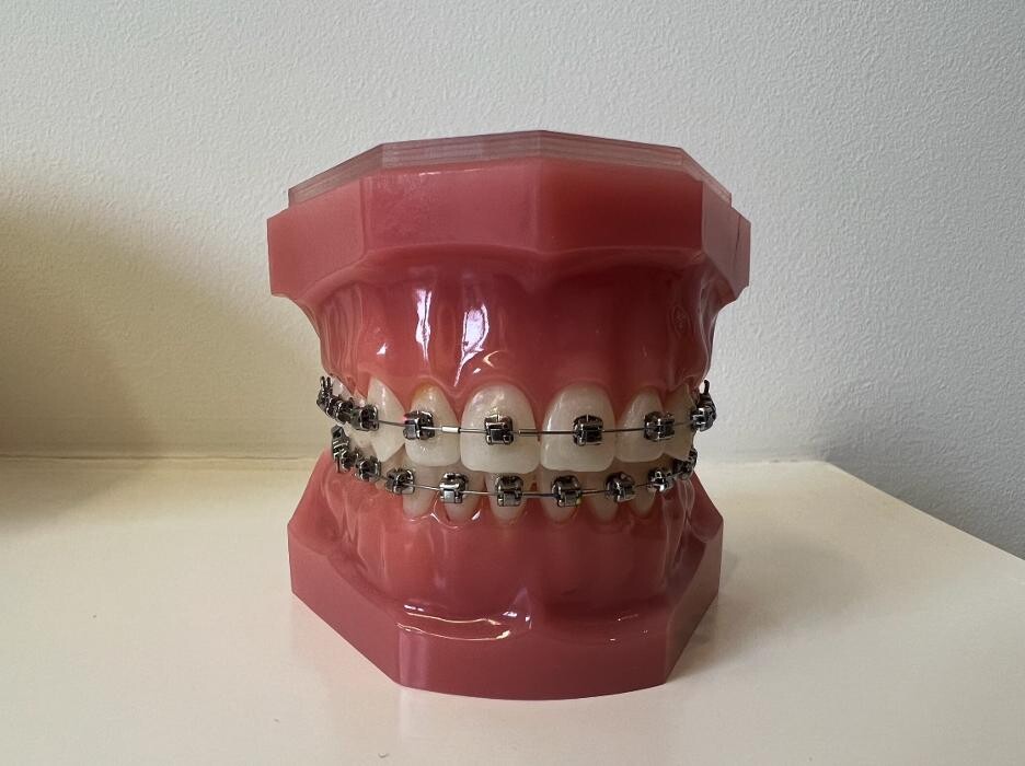 Bilder L'Orthodontiste numérique - Dr Tobler et Dr Le Carboulec