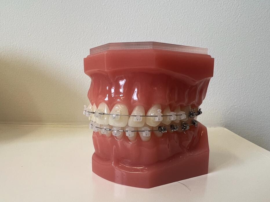 Bilder L'Orthodontiste numérique - Dr Tobler et Dr Le Carboulec