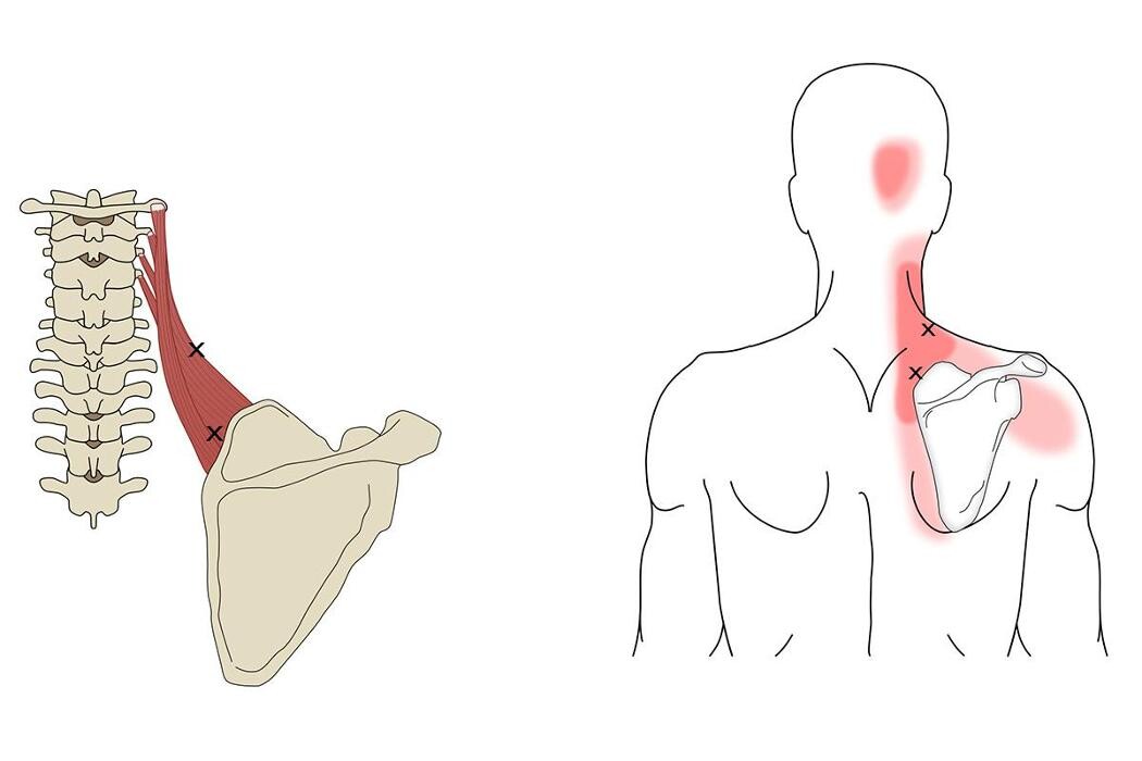 Bilder Physiotherapie Moser & Klumpp