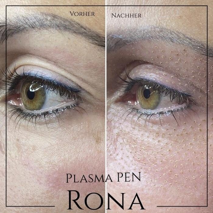 Bilder RONA medical cosmetics