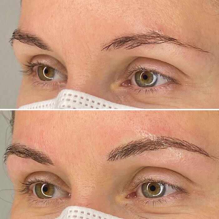 Bilder RONA medical cosmetics