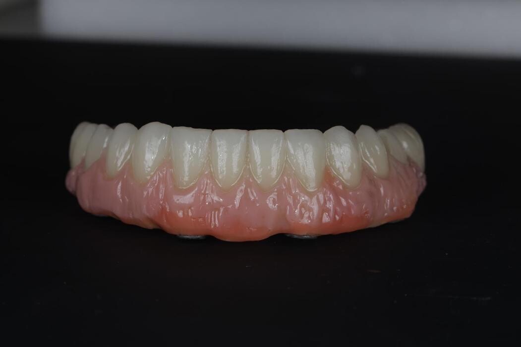 Bilder ModeLab Dental