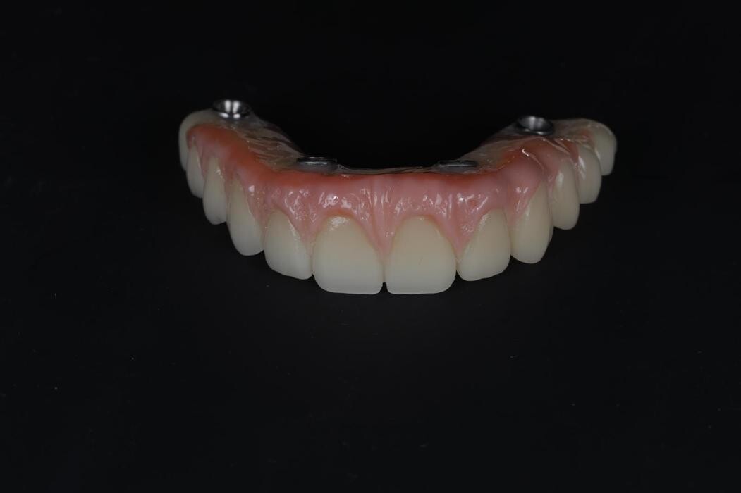 Bilder ModeLab Dental