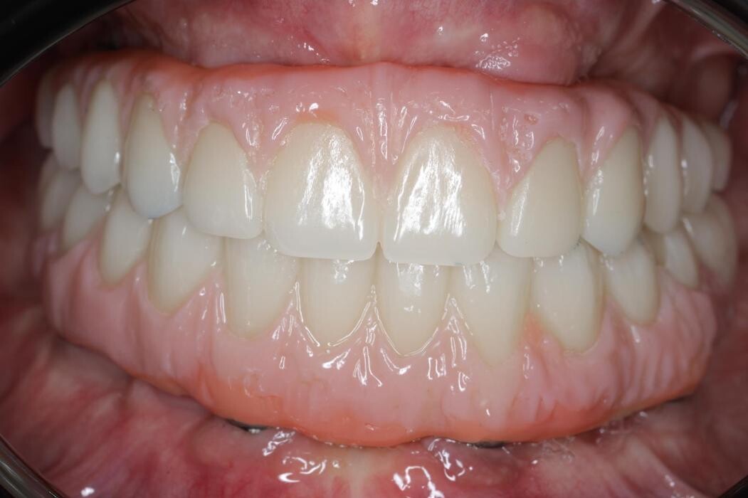 Bilder ModeLab Dental