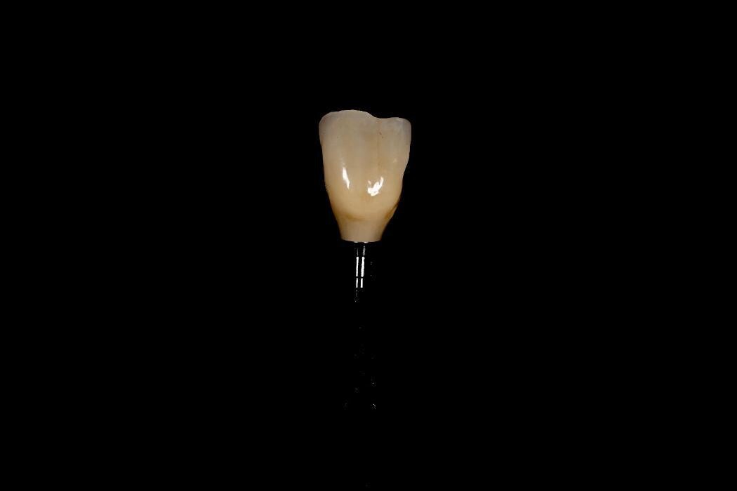 Bilder ModeLab Dental