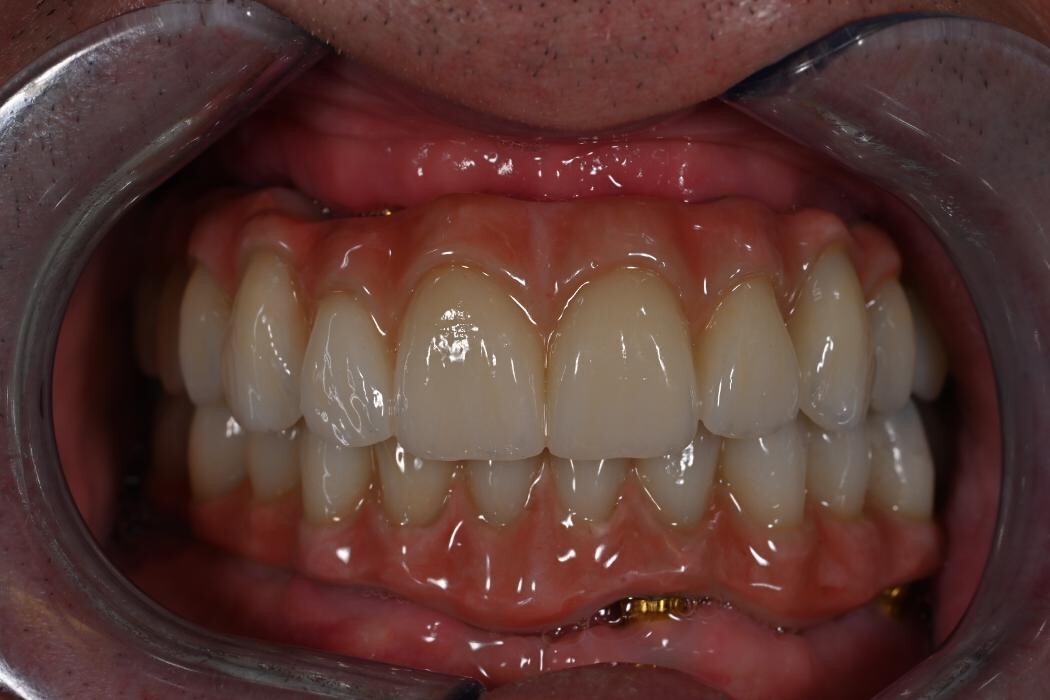 Bilder ModeLab Dental