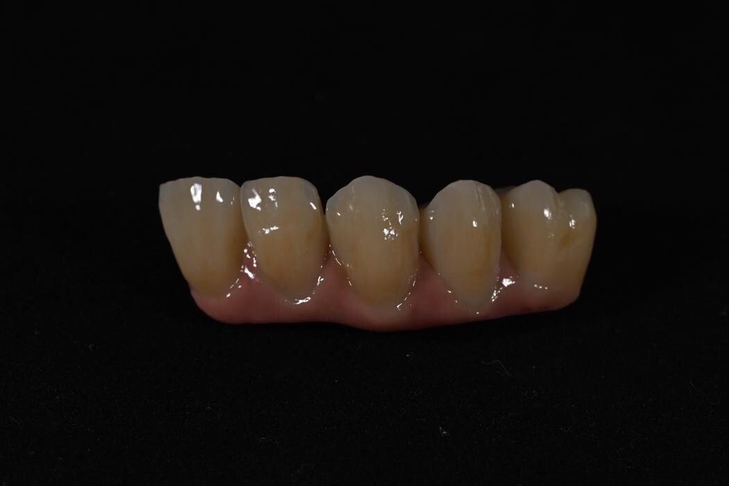 Bilder ModeLab Dental