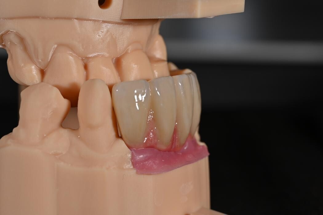 Bilder ModeLab Dental