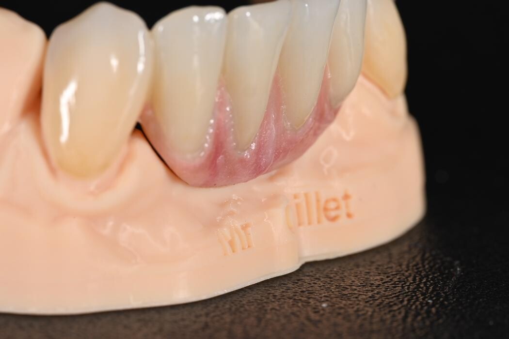 Bilder ModeLab Dental