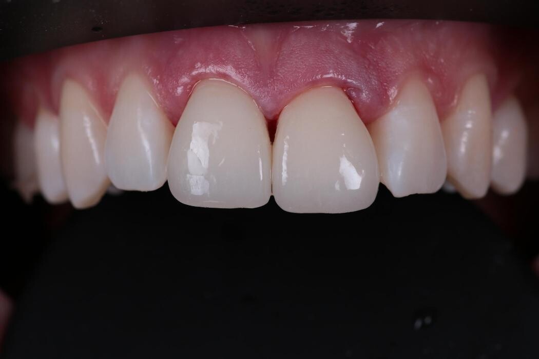 Bilder ModeLab Dental