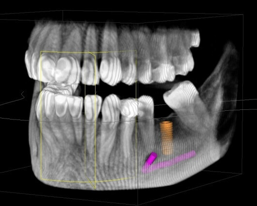 Bilder Dr. Stankovic Feinste Zahnmedizin