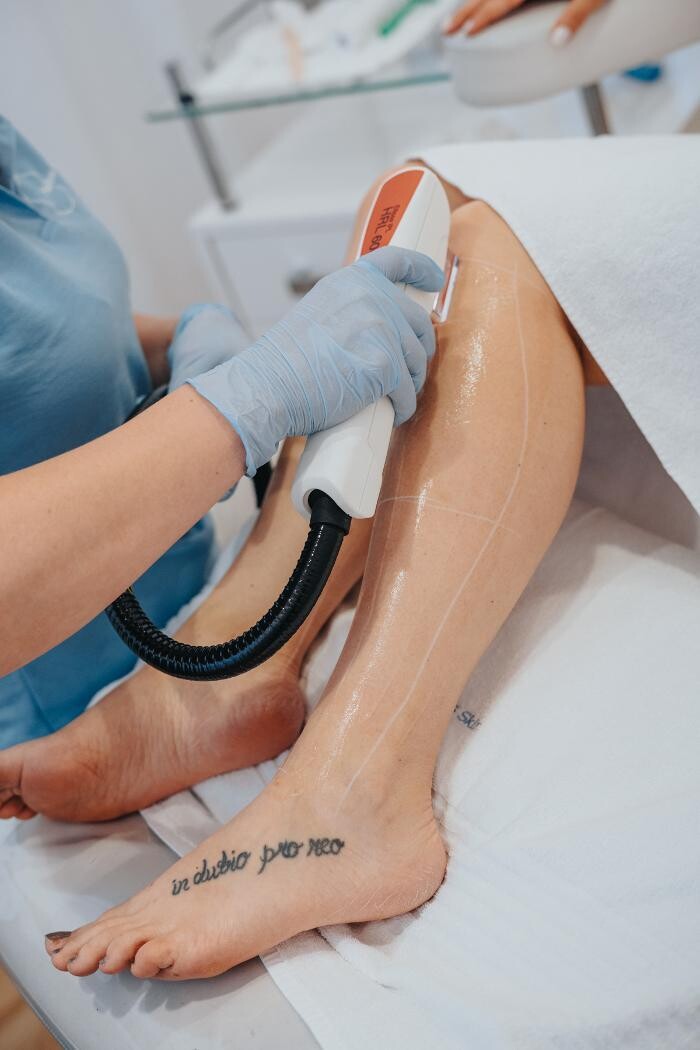 Bilder Haarentfernung Erding - Hairless Skin