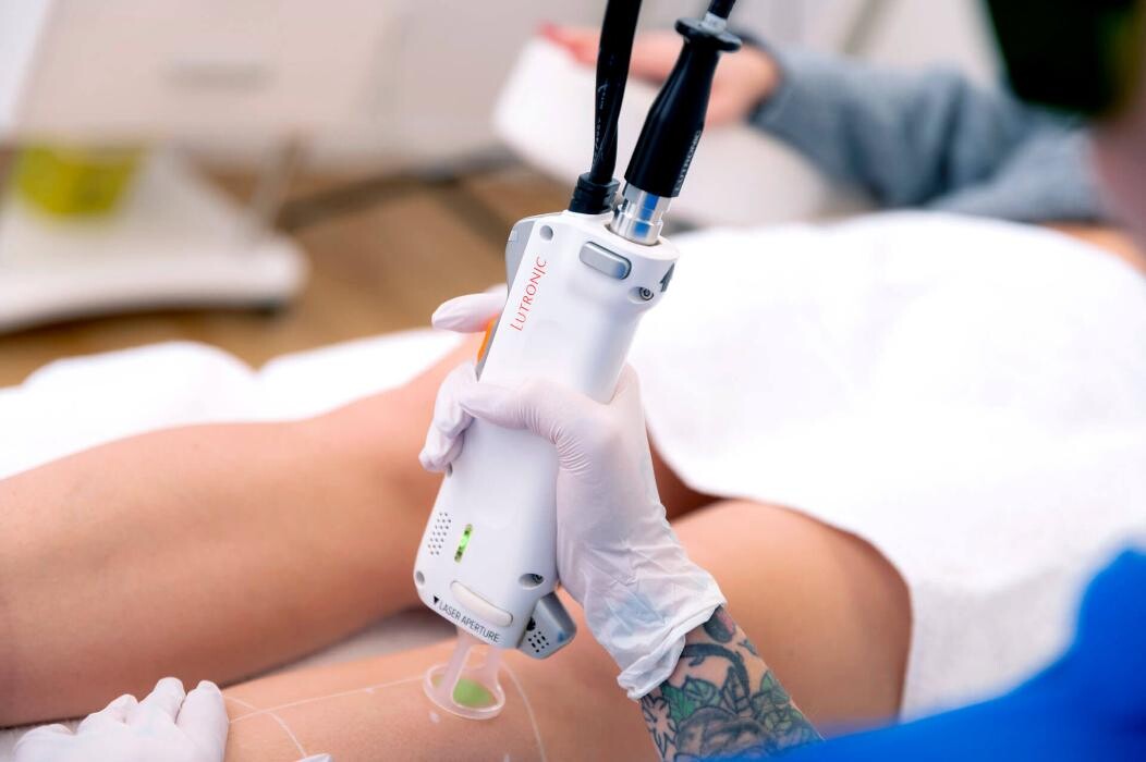 Bilder simplyhairless by PurePulse Fachzentrum Mannheim