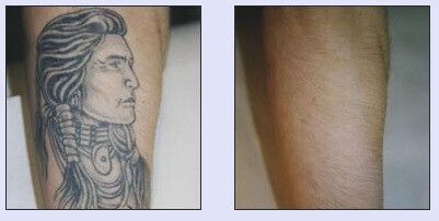 Bilder Meyers Catering GmbH