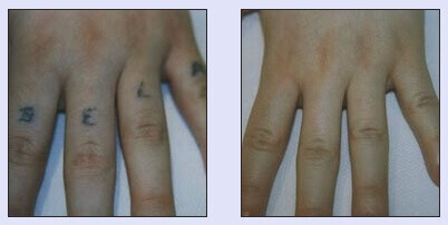 Bilder Meyers Catering GmbH