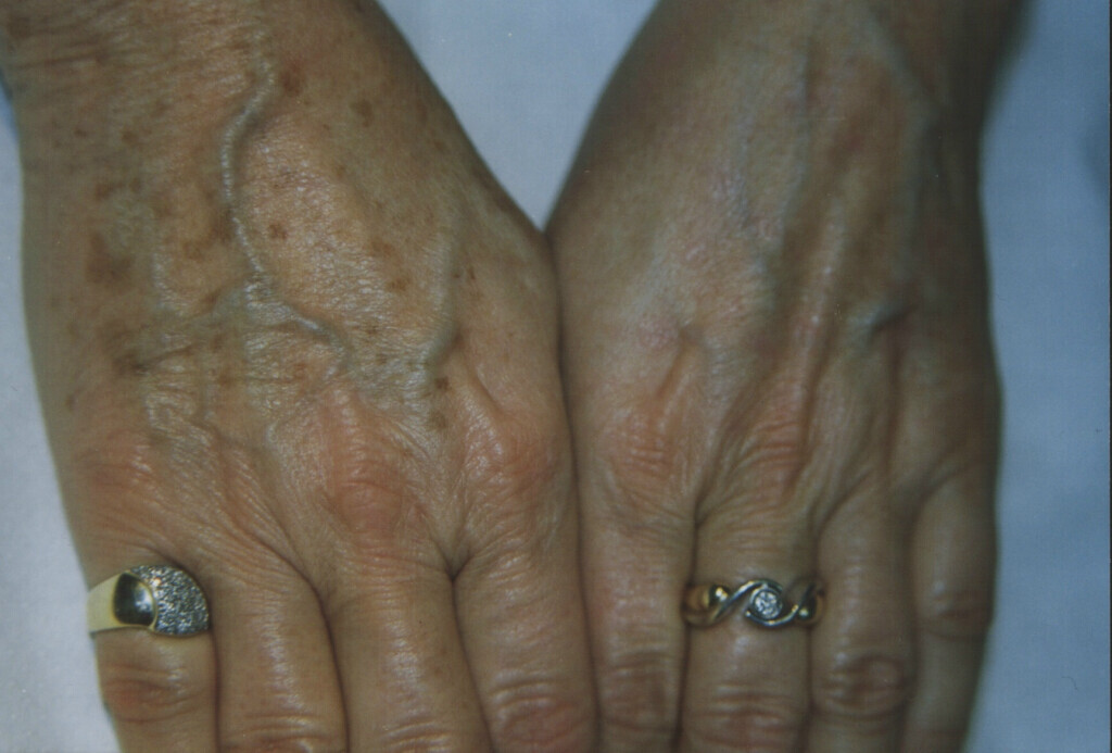 Bilder Meyers Catering GmbH