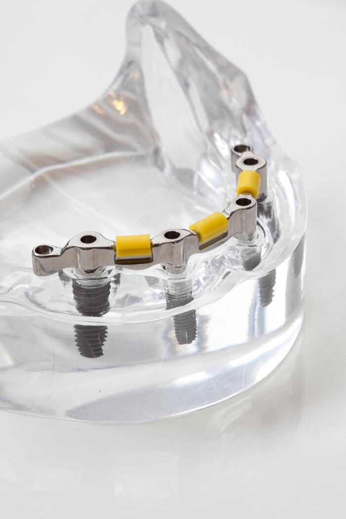 Bilder Neue Zähne Dentallabor GmbH & Co. KG