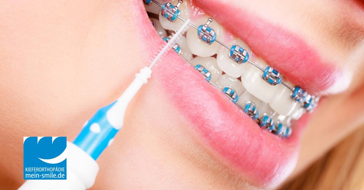 Bilder mein-smile Kieferorthopädie - Dr. Dirk Kujat MSc & Kollegen