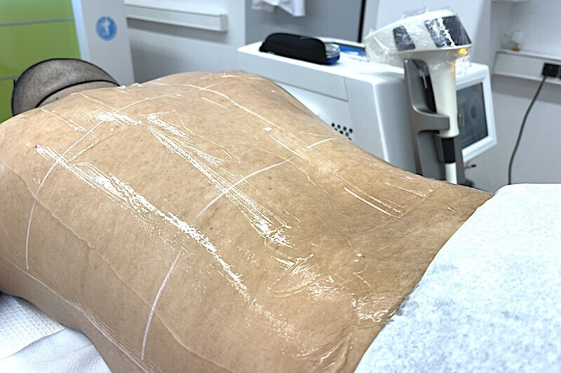 Bilder RPM Medical & Kosmetik®