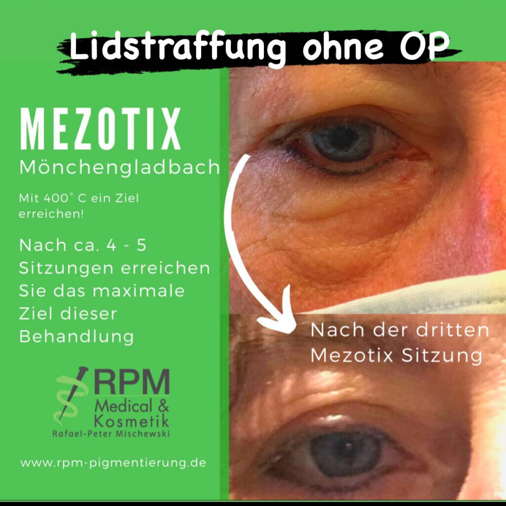 Bilder RPM Medical & Kosmetik®