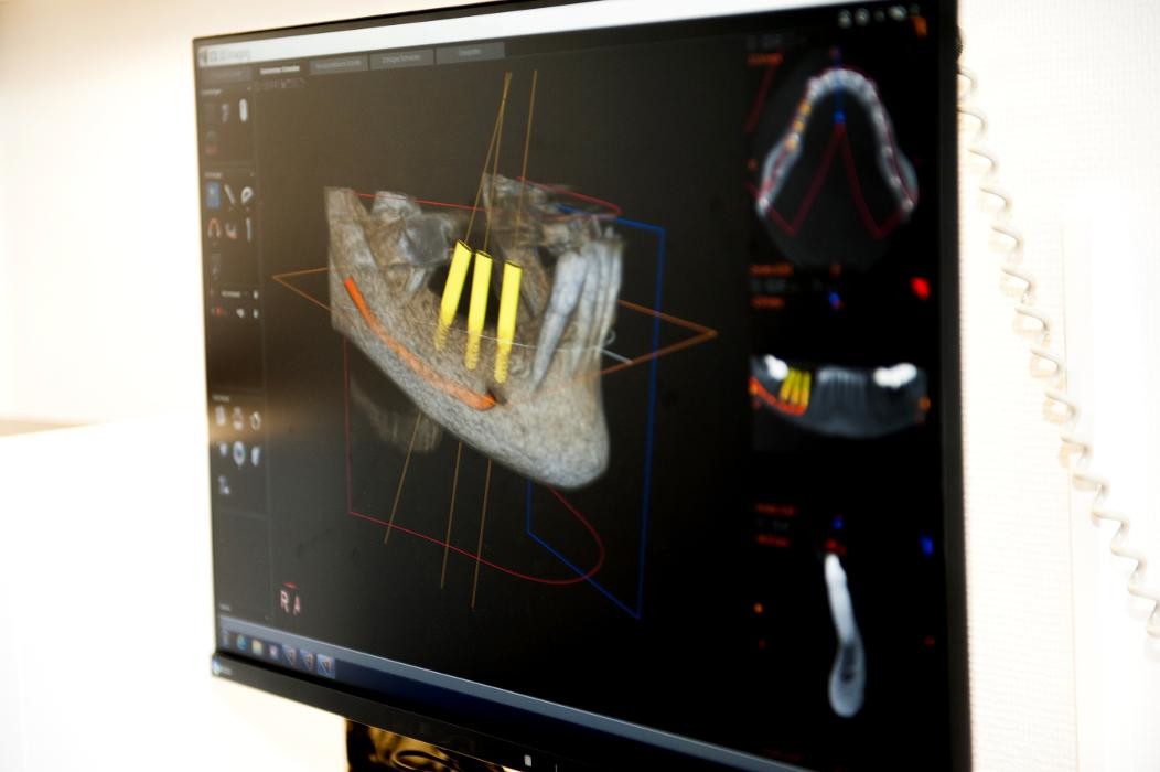 Bilder Dr.Dr. Lind und Kollegen, Praxis für Implantologie und Zahnmedizin