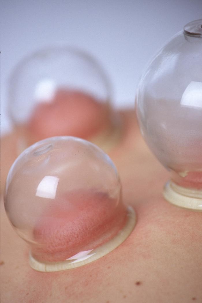 Bilder Augenakupunkturzentrum