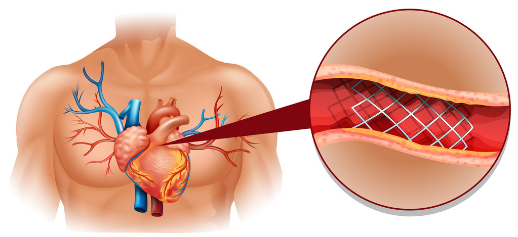 Bilder Kardiologie Altdorf