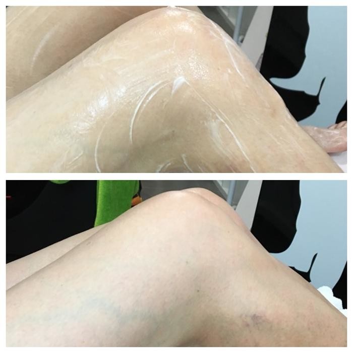 Bilder Ipanema Waxing, Beauty & Bademode
